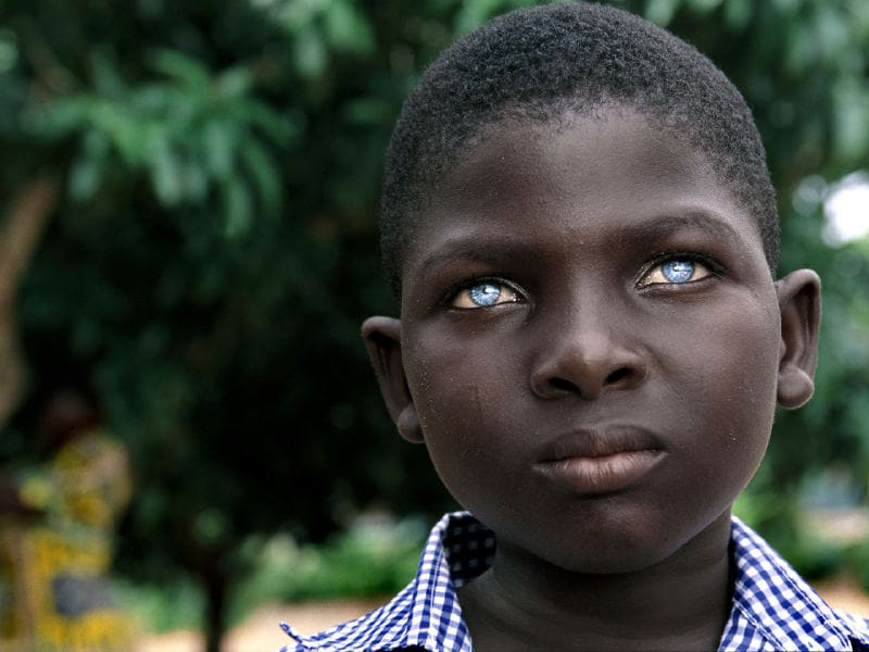 african baby with blue eyes