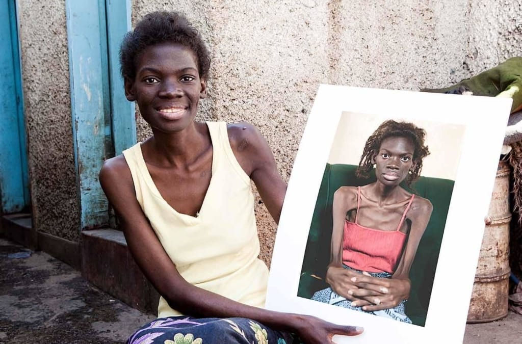 HIV Vaccine Trials Begin in South Africa Ahead of World AIDS Day