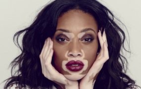 Winnie Harlow on the times she got rejected before raising over $6M for her skincare brand 