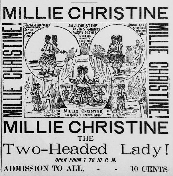 Millie and Christine McKoy, the enslaved conjoined twins who escaped freak shows and travelled the world as performers in the 1800s