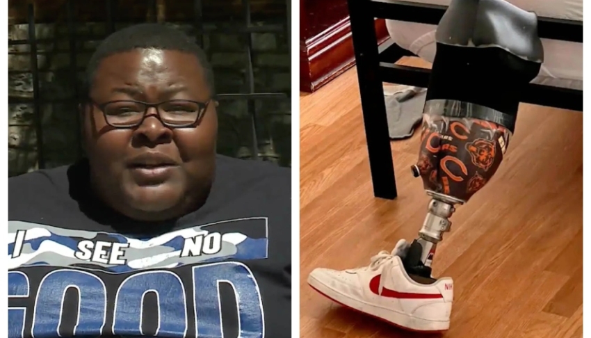 American Airlines refuses to reimburse St. Louis man after allegedly misplacing his $26k prosthetic leg