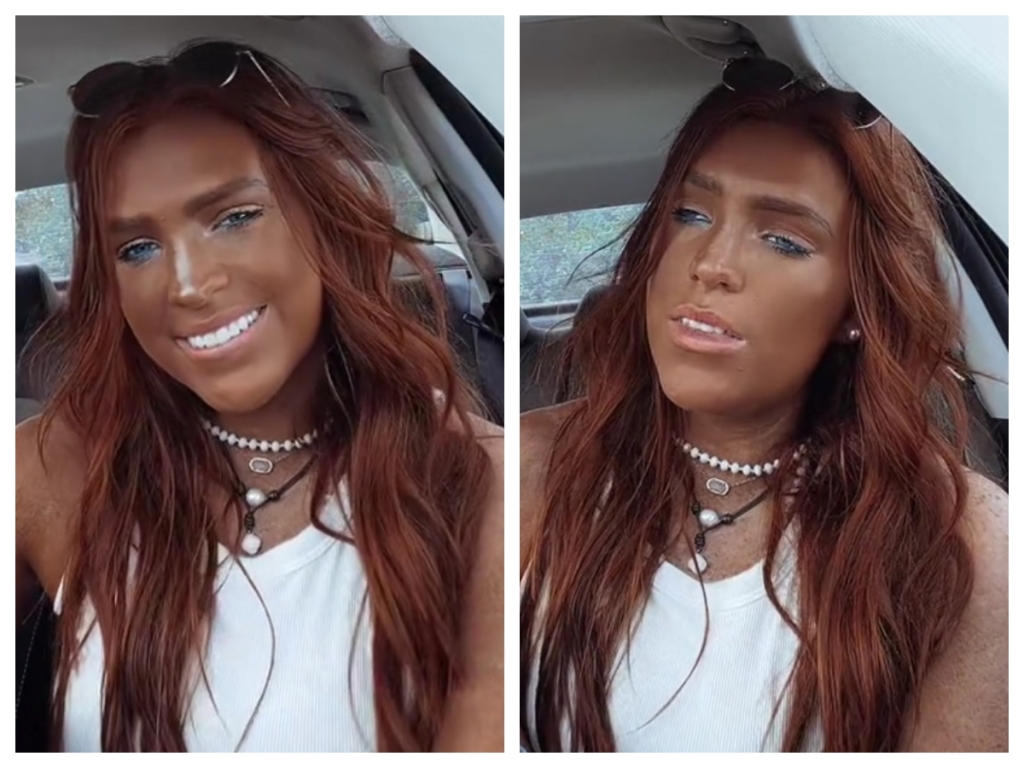Woman accused of blackface after years of selftanning changes her skin