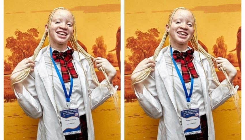 15-year-old lost dad to skin cancer, so she developed organic sunscreen to help people with albinism 