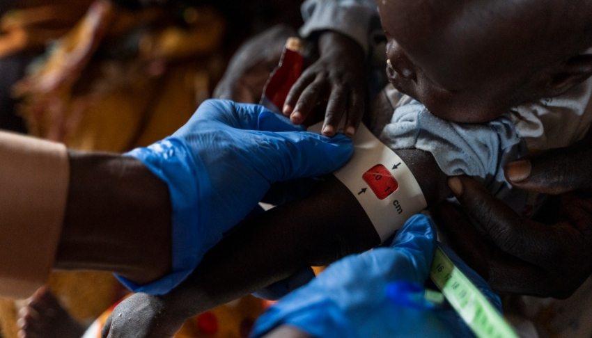 Thirteen children die of malnutrition in Sudan camp amid worsening war and famine