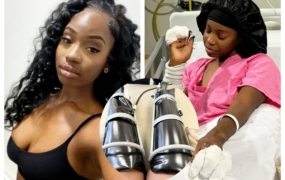 Teen with modeling dreams has legs and fingers amputated after she mistook meningitis for the flu