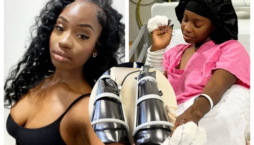 Teen with modeling dreams has legs and fingers amputated after she mistook meningitis for the flu