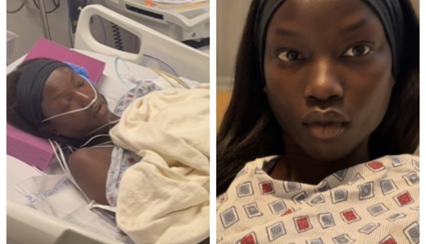 Supermodel Anok Yai reveals diagnosis that was ‘destroying my lungs’