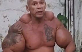 ‘Brazilian Popeye’ – Bodybuilder known for injecting mineral oil and alcohol into his arms dies aged 55