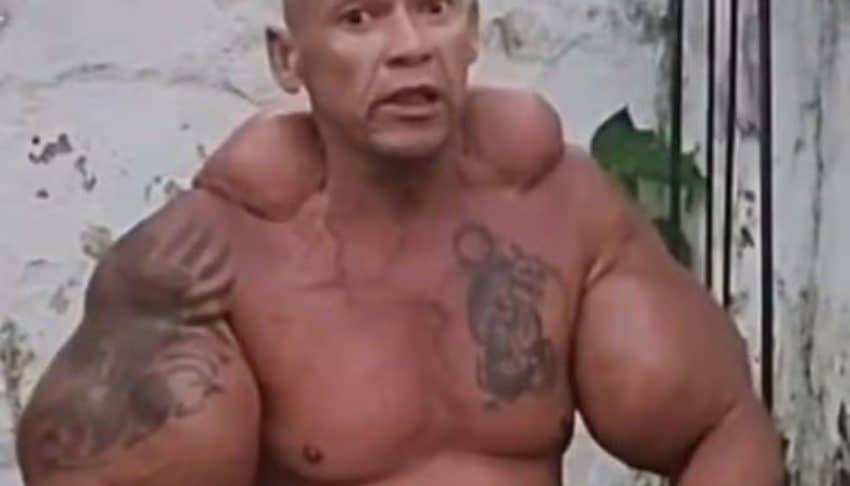 ‘Brazilian Popeye’ – Bodybuilder known for injecting mineral oil and alcohol into his arms dies aged 55