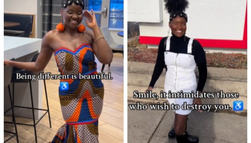 How this mom rose above limb differences through modeling: ‘Fashion became therapeutic’