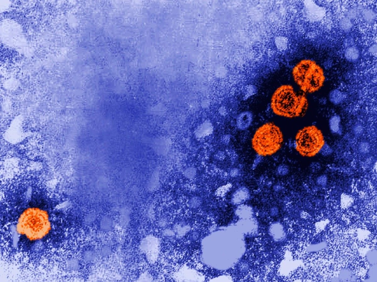 This electron microscope image from 1981, released by the U.S. Centers for Disease Control and Prevention, shows hepatitis B virus particles highlighted in orange.
