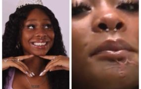 Teen gets new face as doctors use AI to rebuild her jaw after being shot