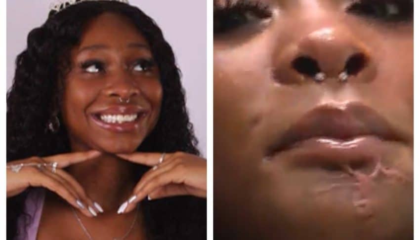 Teen gets new face as doctors use AI to rebuild her jaw after being shot